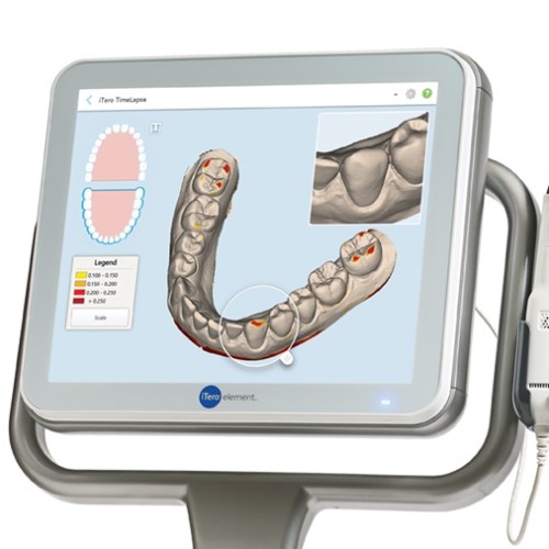 最新の光学式スキャナ